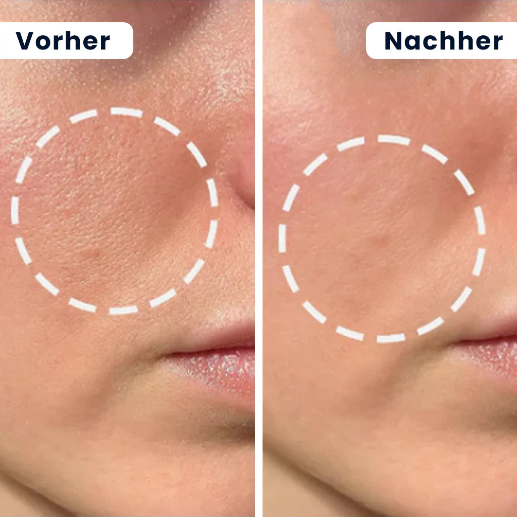 Dr. Melaxin™ Reis Peeling Serum